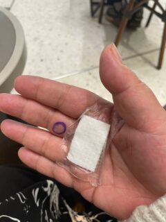 【術後２日目】

術後の診察受けてきました。
腫れなし。痛みなし、もう痛み止めも飲んで無い。感覚異常もなし。
皮膚の奥を縫ってるので抜糸もなしだそうです。
包帯も取って絆創膏一枚になりました。
しばらく水や土いじりはしないでねって。（笑）

リハビリは、指をのばす事。
先生がやってくれたけど優しい。
痛み我慢できて偉いねと誉めてもらってちょっと嬉しい。

ほっと一息虎ノ門ヒルズ駅でコーヒーちゅう。

20年前の左手のバネ指手術の大変さと違いすぎる。

昔は術後すごく痛くて、ゴム手袋に水入れたみたいにバンバンに腫れて、しかも10日過ぎても腫れが引かず、痛みが続き辛かった。
それでも何とか腫れがひいて抜糸したけど指が固まって、いきなり指逆反りリハビリやられて、空いてる右手で先生をグーパンチくらわしそうになったくらい激痛だったのです。

そんな経験があったので、昨日からじんわり伸ばしていたのでした。

もうギター弾けそうだけど、爪全部切ったので、伸びるまでは我慢。